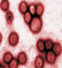 Janilink's just-the-facts: swine flu